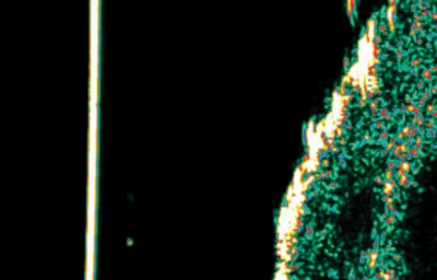 Ultrasound after GentleCure treatment